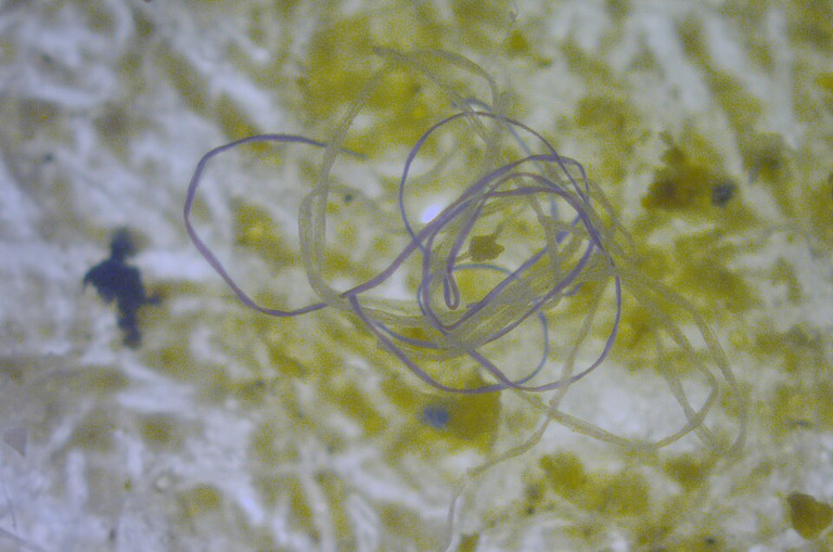 Microplastics in the ocean